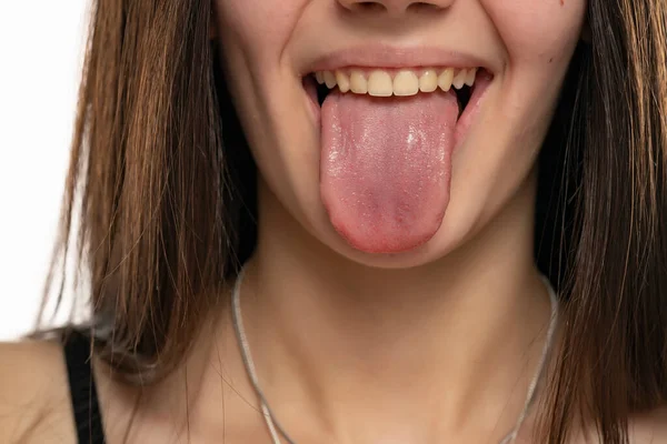 Язик жінки став чорним і волохатим через антибіотик: фото ➤ Prozoro.net.ua