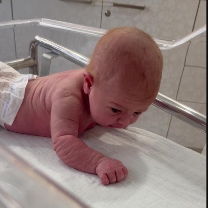 Дитина на третій день від народження навчилася тримати голову та повзати ➤ Prozoro.net.ua
