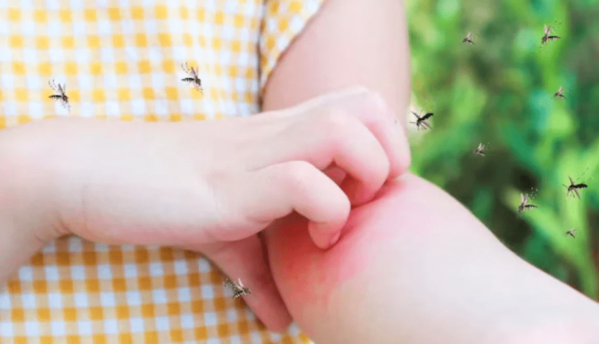 Найкращий народний засіб від комарів: жоден кровопивця не підлетить ➤ Prozoro.net.ua