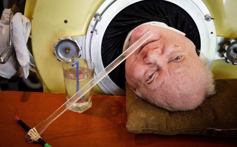 Не рухається 70 років: небезпечна хвороба вклала чоловіка у “залізну легеню” ➤ Prozoro.net.ua