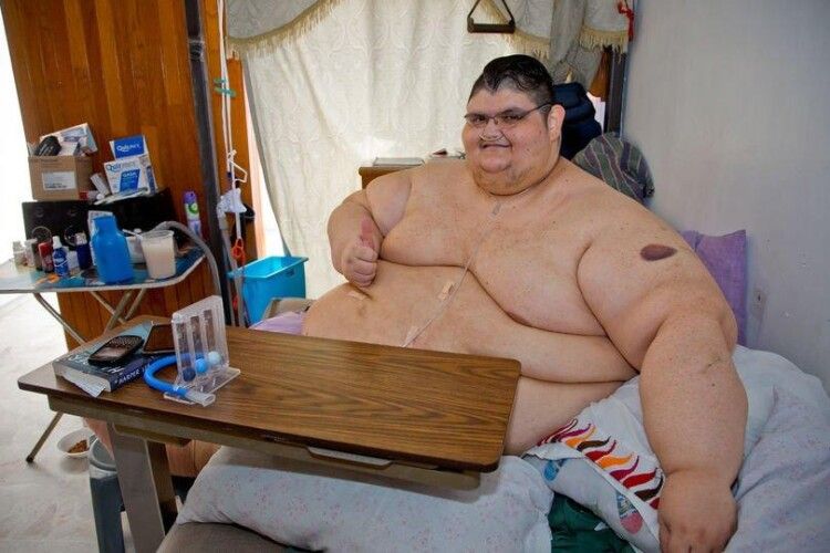 Найважчий чоловік у світі схуд на 330 кг та показав нові фото
