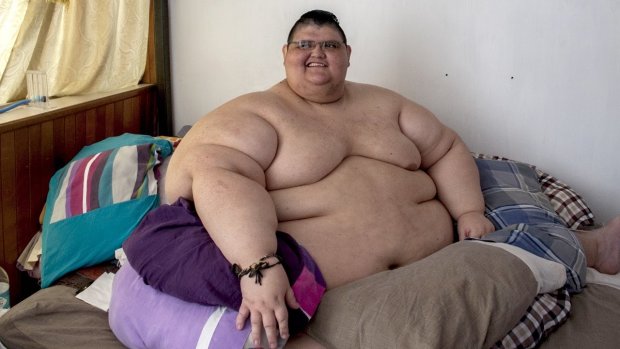 Найважчий чоловік у світі схуд на 330 кг та показав нові фото