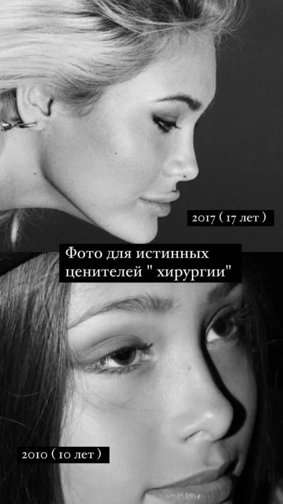 Доменіка і пластика обличчя